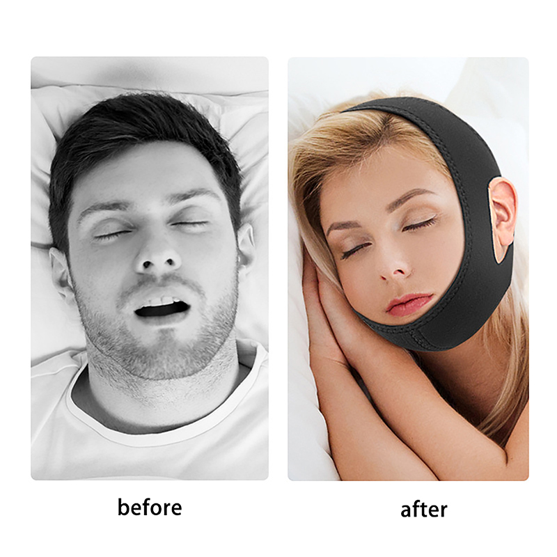 Tali Anti Dengkuran Neoprena y - Anti Snore Chin Strap Adjustable ulasan dan harga